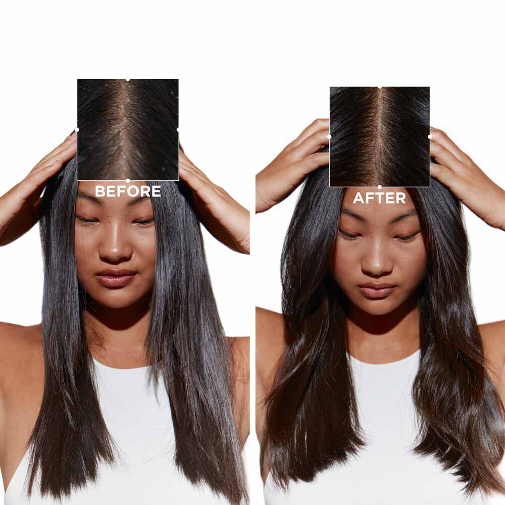 Bain Purete Anti-Pelliculaire