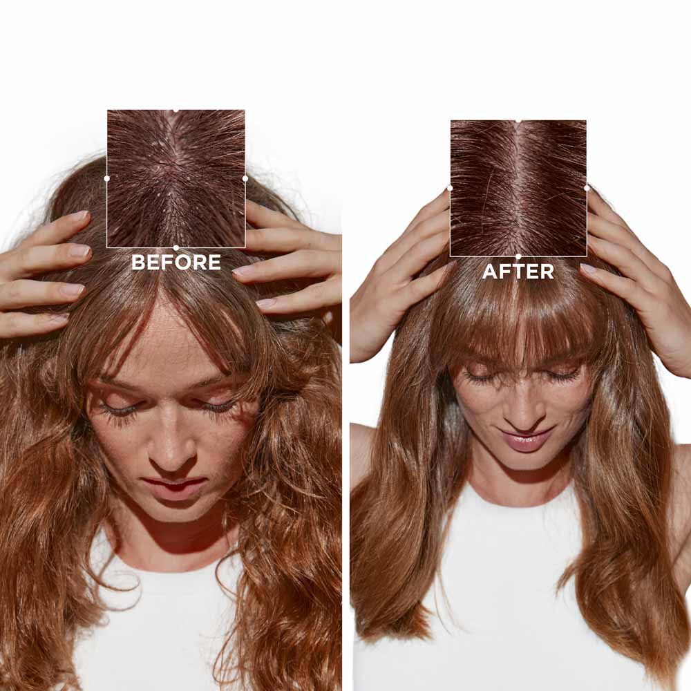 Micro-Peeling Cellulaire