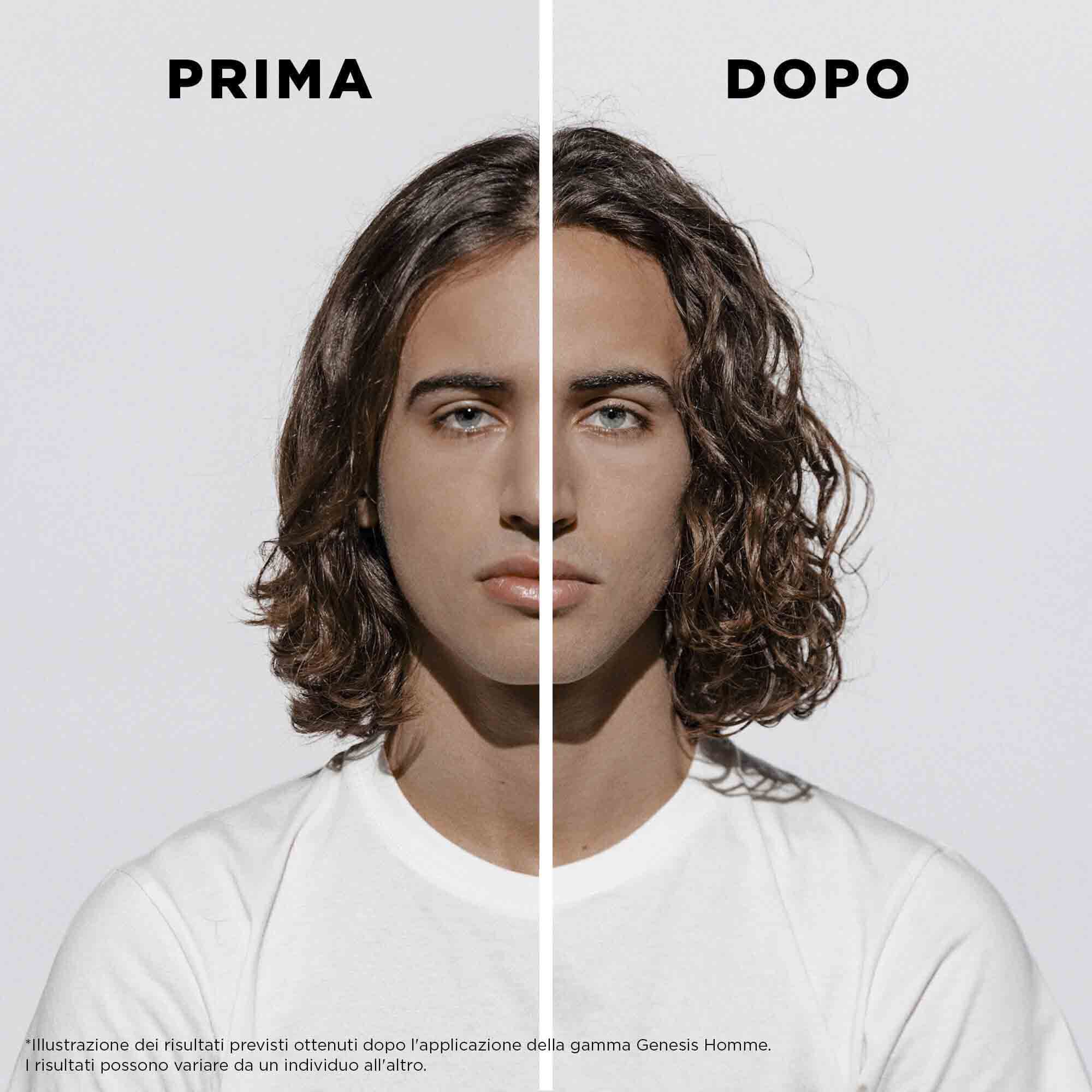 CAPELLI INDEBOLITI, TENDENTI ALL'ASSOTTIGLIAMENTO